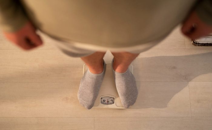 Managing Fluid and Weight Between Dialysis Sessions